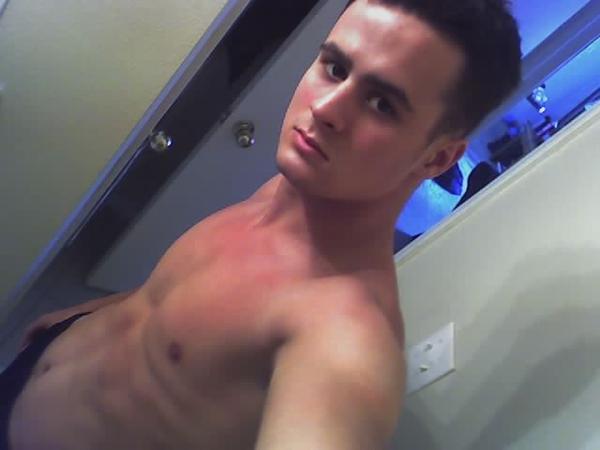 Spencer sun burnt